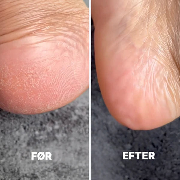 Æra Care Gen-Exfo™ Nano-Glas Fodfil – Effektiv Mod Hård & Tør Hud
